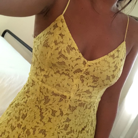 Yellow Lace Mid-Length Dress - Picture 7 of 7